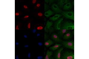 ABIN6257614 and ABIN6275206 staining  cells by IF/ICC.