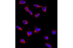 Immunofluorescence analysis of CD9 polyclonal antibody  in HeLa cells. (CD9 Antikörper  (Internal Region))