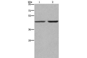 Western Blot analysis of MCF-7 and 231 cell using GABPB2 Polyclonal Antibody at dilution of 1:550 (GABPB2 Antikörper)