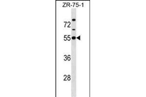 KCNJ1 Antibody (C-term) (ABIN1537138 and ABIN2850385) western blot analysis in ZR-75-1 cell line lysates (35 μg/lane). (KCNJ1 Antikörper  (C-Term))