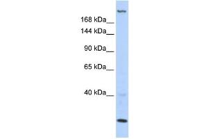 WB Suggested Anti-TNRC6B Antibody Titration:  0. (TNRC6B Antikörper  (N-Term))