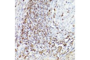 Immunohistochemistry of paraffin-embedded Human tonsil(400X) using Bcl-2 antibody (ABIN7265810) at dilution of 1:100 (40x lens). (Bcl-2 Antikörper)