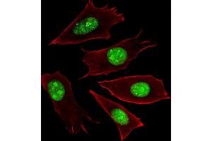 Fluorescent image of NIH/3T3 cells stained with RN Antibody (Center) C.
