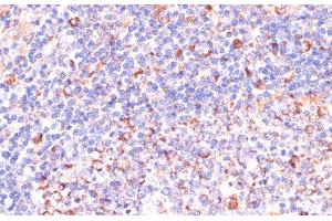Immunohistochemistry of paraffin-embedded Human tonsil using VHL Polyclonal Antibody at dilution of 1:200 (40x lens). (VHL Antikörper)