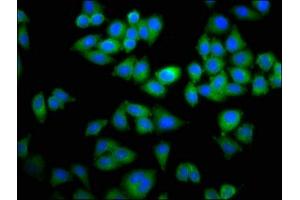Immunofluorescence staining of Hela cells with ABIN7150346 at 1:100, counter-stained with DAPI. (TOP2B Antikörper  (AA 1400-1626))