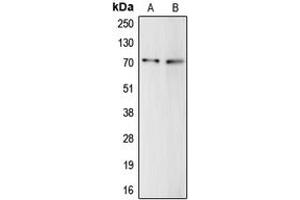 Western blot analysis of Complement C9 expression in HepG2 (A), THP1 (B) whole cell lysates. (C9 Antikörper  (Center))