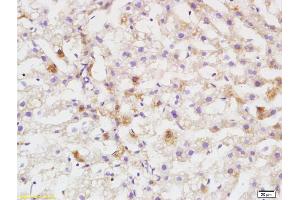 Formalin-fixed and paraffin embedded rat liver labeled with Anti DEPTOR/DEPDC6 Polyclonal Antibody, Unconjugated (ABIN1387597) at 1:200 followed by conjugation to the secondary antibody and DAB staining (DEPTOR Antikörper  (AA 56-170))