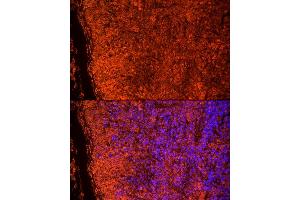 Immunofluorescence (IF) image for anti-Toll-Like Receptor 7 (TLR7) (AA 30-230) antibody (ABIN3021247)
