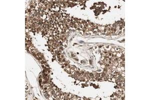 Immunohistochemical staining of human testis with CNOT4 polyclonal antibody  shows strong cytoplasmic positivity in cells of seminiferus ducts. (CNOT4 Antikörper)