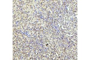 IHC analysis of PTBP1 using anti-PTBP1 antibody (ABIN7599451). (PTBP1 Antikörper  (AA 1-504))