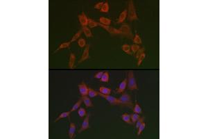 Immunofluorescence analysis of NIH/3T3 cells using HSP47/SERPINH1 Rabbit pAb  at dilution of 1:100 (40x lens). (SERPINH1 Antikörper)
