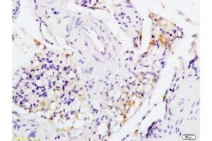 Immunohistochemistry (Paraffin-embedded Sections) (IHC (p)) image for anti-Interleukin 1 Receptor, Type I (IL1R1) (AA 481-569) antibody (ABIN747743)