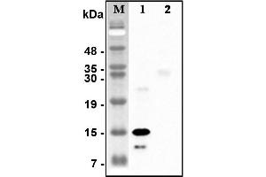 Western blot analysis of recombinant human CTRPs using anti-CTRP5 (human), pAb  at 1:4,000 dilution.