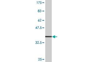 Western Blot detection against Immunogen (32. (SLC11A2 Antikörper  (AA 1-65))