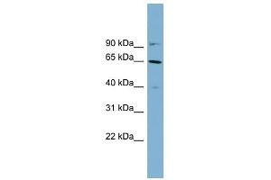 Cytokeratin 84 antibody used at 1 ug/ml to detect target protein. (Keratin 84 Antikörper  (Middle Region))
