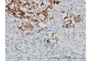Immunoperoxidase of monoclonal antibody to DCN on formalin-fixed paraffin-embedded human adrenal gland.