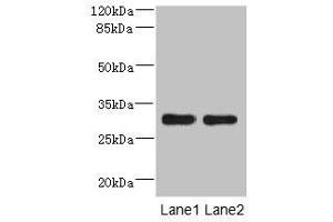 Western blot All lanes: DRAM2 antibody at 3. (DRAM2 Antikörper  (AA 182-266))