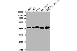 Western Blot Positive WB detected in: A549 whole cell lysate, 293T whole cell lysate, U251 whole cell lysate, Rat Brain tissue, Rabbit Skeletal Muscle tissue All lanes: PKM antibody at 1:1000 Secondary Goat polyclonal to Mouse IgG at 1/10000 dilution Predicted band size: 58 kDa Observed band size: 58 KDa Exposure time: 1 min (PKM Antikörper  (AA 2-531))