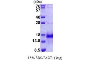 SDS-PAGE (SDS) image for Immediate Early Response 3 (IER3) (AA 1-82) protein (His tag) (ABIN6387207) (IER3 Protein (AA 1-82) (His tag))