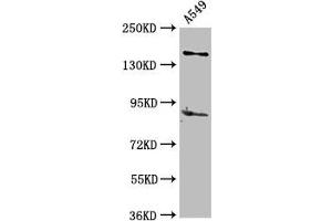 Western Blot Positive WB detected in: A549 whole cell lysate All lanes: AFF2 antibody at 5 μg/mL Secondary Goat polyclonal to rabbit IgG at 1/50000 dilution Predicted band size: 145, 141, 48, 144, 106 kDa Observed band size: 145 kDa