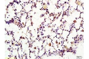 Formalin-fixed and paraffin embedded rat lung tissue labeled with Anti-Synaptotagmin 1/SYT1 Polyclonal Antibody, Unconjugated  at 1:200 followed by conjugation to the secondary antibody, (SP-0023), and DAB staining