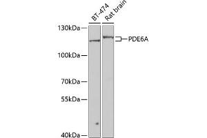 Western blot analysis of extracts of various cell lines, using PDE6A antibody (ABIN6130650, ABIN6145361, ABIN6145362 and ABIN6223910) at 1:1000 dilution. (PDE6A Antikörper  (AA 656-860))