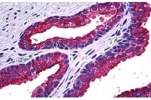 Human Prostate: Formalin-Fixed, Paraffin-Embedded (FFPE) (NPR2 Antikörper  (AA 131-231))