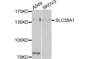 Western blot analysis of extract of A549 and SKOV3 cells, using EMILIN1 antibody.