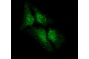 ICC/IF analysis of LSM5 in HeLa cells line, stained with DAPI (Blue) for nucleus staining and monoclonal anti-human LSM5 antibody (1:100) with goat anti-mouse IgG-Alexa fluor 488 conjugate (Green). (LSM5 Antikörper)