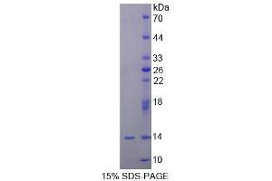 SDS-PAGE (SDS) image for Ubiquilin 2 (UBQLN2) (AA 33-126) protein (His tag) (ABIN4990628) (Ubiquilin 2 Protein (UBQLN2) (AA 33-126) (His tag))