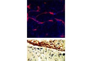 TOP: Methanol/Acetone fixed human stem cell is used in IF to detect Eph4A (blue) and endothelial Lectin(red). (EPH Receptor A4 Antikörper  (N-Term))