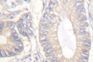 Image no. 1 for anti-Gastrin (GAST) antibody (ABIN265432) (Gastrin Antikörper)