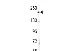 Western blot analysis of COL5A2 Antibody (N-term) (ABIN391537 and ABIN2841488) in mouse lung tissue lysates (35 μg/lane). (COL5A2 Antikörper  (N-Term))