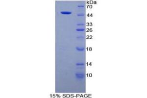 SDS-PAGE (SDS) image for Fibrillin 1 (FBN1) ELISA Kit (ABIN6574170)