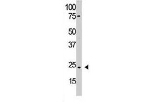 The PDGFA polyclonal antibody  is used in Western blot to detect PDGFA in HL-60 cell lysate. (PDGFA Antikörper  (N-Term))