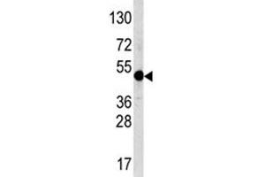 Western blot analysis of AP2 antibody and NCI-H460 lysate.