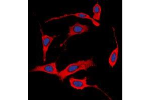 Immunofluorescent analysis of HER4 (pY1284) staining in MCF7 cells. (ERBB4 Antikörper  (C-Term, pTyr1284))
