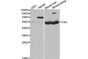 Western blot analysis of extracts of various cell lines, using PAH antibody. (Phenylalanine Hydroxylase Antikörper  (AA 1-290))