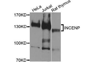 Western blot analysis of extracts of various cells, using INCENP antibody. (INCENP Antikörper)