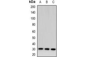 Western blot analysis of TSSK6 expression in HeLa (A), mouse testis (B), rat testis (C) whole cell lysates.