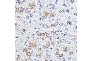 Immunohistochemistry (IHC) image for anti-ELAV (Embryonic Lethal, Abnormal Vision, Drosophila)-Like 4 (Hu Antigen D) (ELAVL4) (AA 1-366) antibody (ABIN7266914)