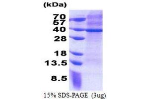 SDS-PAGE (SDS) image for Mitochondrial Ribosomal Protein S2 (MRPS2) (AA 1-296) protein (His tag) (ABIN5853207) (MRPS2 Protein (AA 1-296) (His tag))