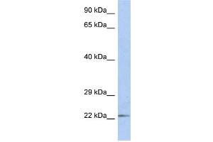 WB Suggested Anti-DUT Antibody Titration:  1 ug/ml  Positive Control:  Fetal Small Intestine cell lysate (Deoxyuridine Triphosphatase (DUT) (N-Term) Antikörper)