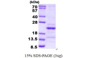 Image no. 1 for Steroid Receptor RNA Activator 1 (SRA1) protein (His tag) (ABIN1098449) (SRA1 Protein (His tag))