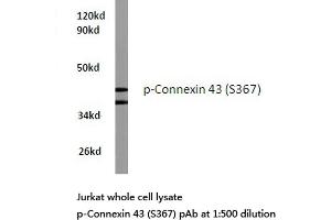 Western blot (WB) analyzes of p-Connexin 43 antibody in extracts from Jurkat cells. (Connexin 43/GJA1 Antikörper  (pSer367))