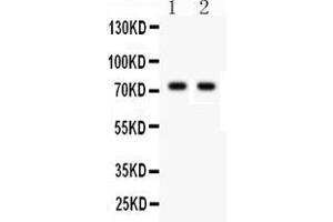 Anti- TNF Receptor II Picoband antibody, Western blottingAll lanes: Anti TNF Receptor II  at 0.