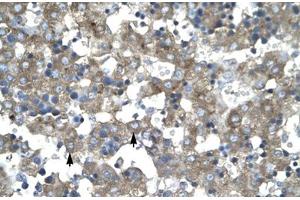 Immunohistochemical staining (Formalin-fixed paraffin-embedded sections) of human liver with KLF15 polyclonal antibody . (KLF15 Antikörper  (AA 45-94))
