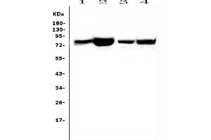 Western blot analysis of PRKCD using anti-PRKCD antibody (ABIN7601631). (PKC delta Antikörper  (AA 4-676))