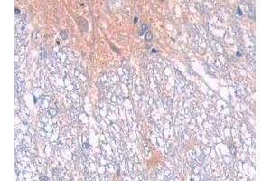 Immunohistochemistry (IHC) image for anti-Membrane Metallo-Endopeptidase (MME) (AA 32-164) antibody (ABIN7437284)
