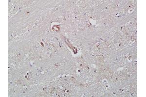 Formalin-fixed and paraffin embedded rat brain labeled with Rabbit Anti-ICAM-2/CD102 Polyclonal Antibody, Unconjugated  at 1:200 followed by conjugation to the secondary antibody and DAB staining (ICAM2 Antikörper  (AA 175-277))